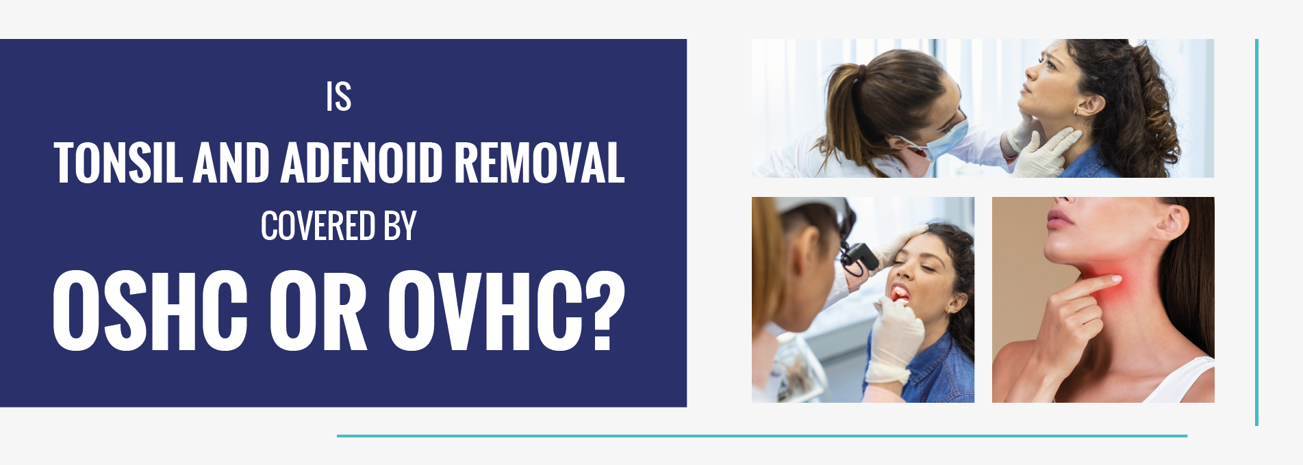 Is Tonsil and Adenoid Removal Covered by OSHC or OVHC?